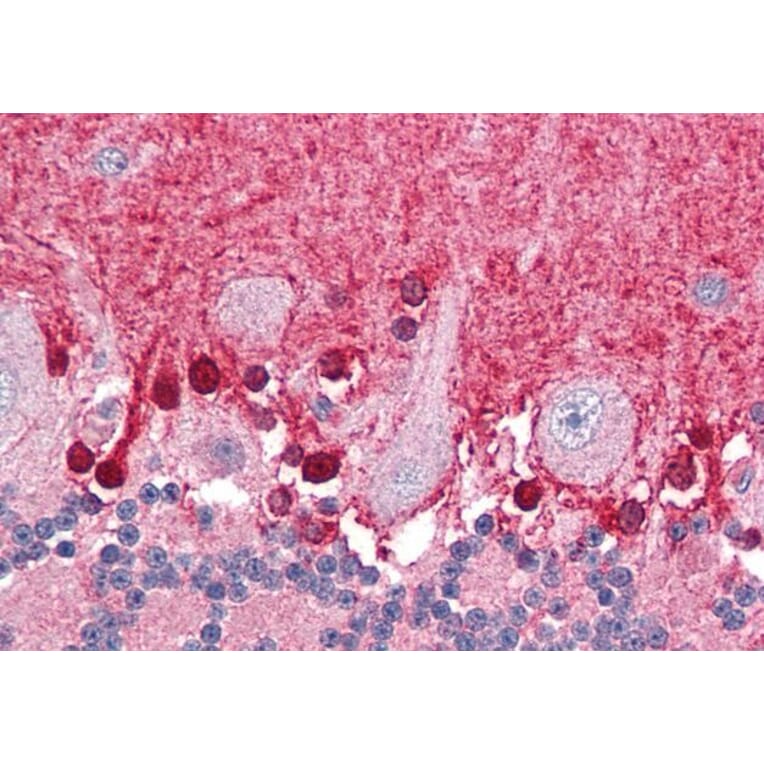 Immunohistochemistry - Anti-BPOZ/ABTB1 Antibody (A83452) - Antibodies.com