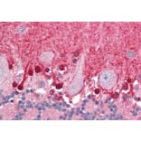 Immunohistochemistry - Anti-BPOZ/ABTB1 Antibody (A83452) - Antibodies.com
