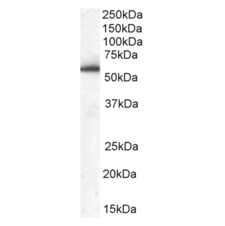 Western Blot - Anti-HIP55 Antibody (A83454) - Antibodies.com