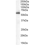 Western Blot - Anti-HIP55 Antibody (A83454) - Antibodies.com