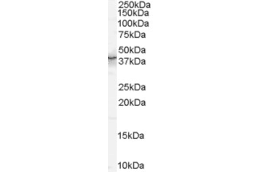 Western Blot - Anti-QKI Antibody (A83456) - Antibodies.com