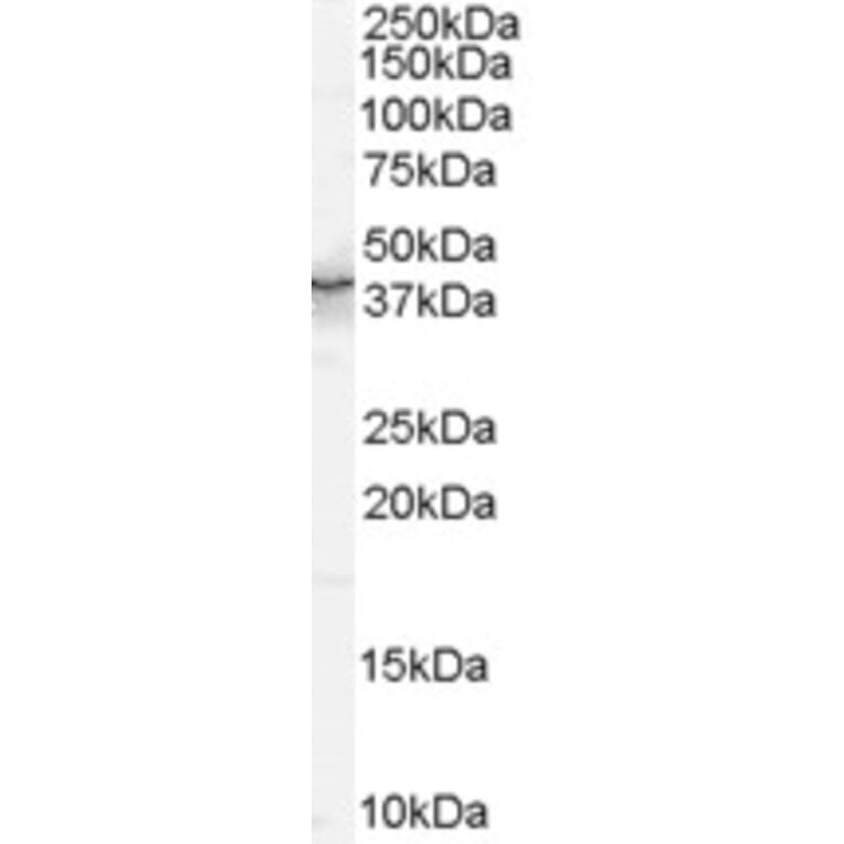 Western Blot - Anti-QKI Antibody (A83456) - Antibodies.com