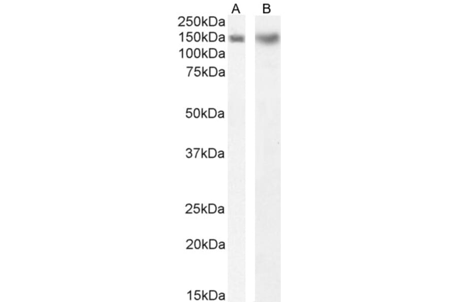 Western Blot - Anti-DCTN1/p150-glued Antibody (A83458) - Antibodies.com