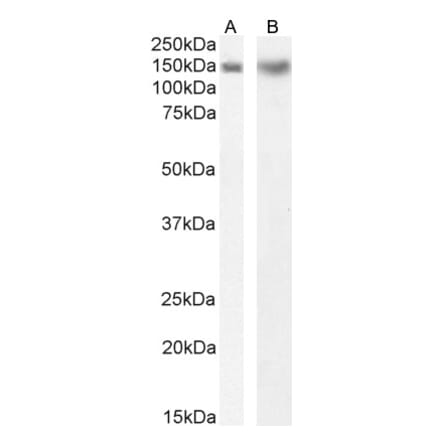 Western Blot - Anti-DCTN1/p150-glued Antibody (A83458) - Antibodies.com
