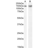 Western Blot - Anti-DCTN1/p150-glued Antibody (A83458) - Antibodies.com