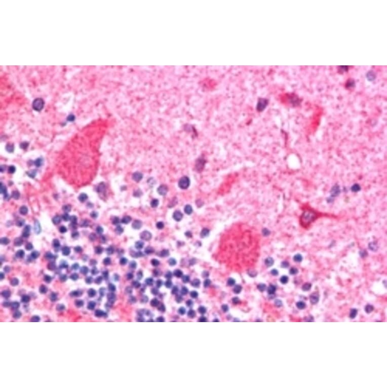 AntiDCTN1 Antibody (A83458)