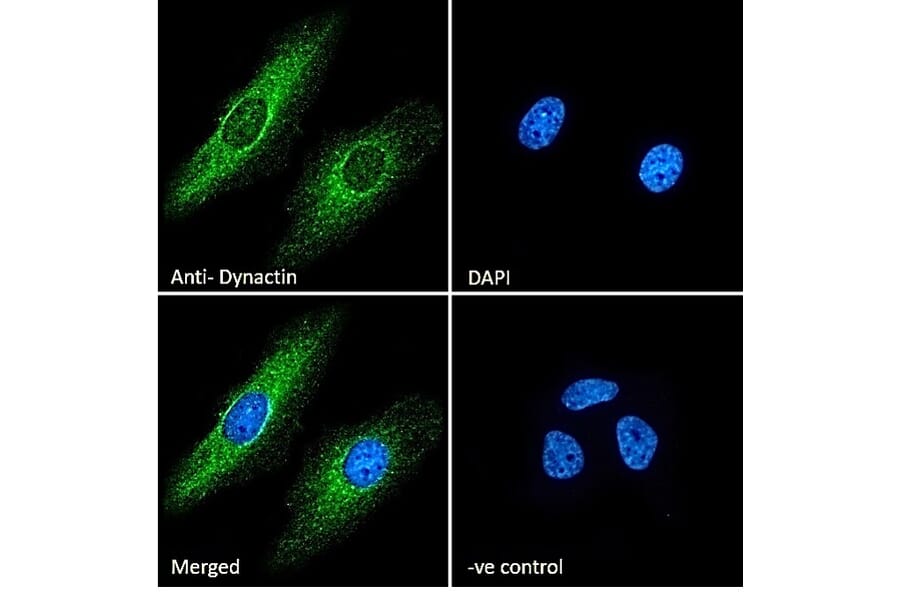 Immunofluorescence - Anti-DCTN1/p150-glued Antibody (A83458) - Antibodies.com