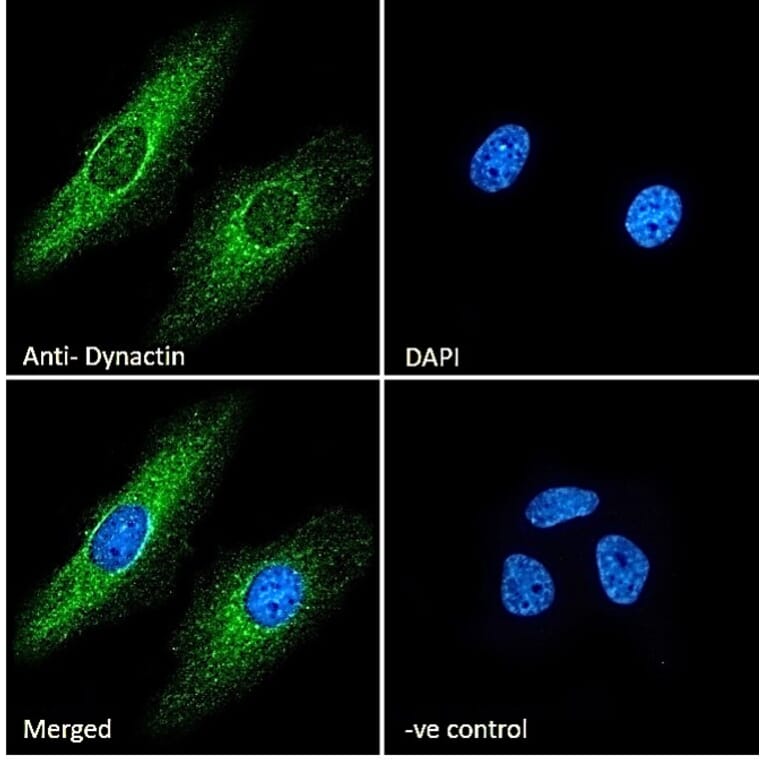 Immunofluorescence - Anti-DCTN1/p150-glued Antibody (A83458) - Antibodies.com