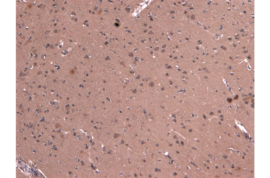 Immunohistochemistry - Anti-DCTN1/p150-glued Antibody (A83458) - Antibodies.com