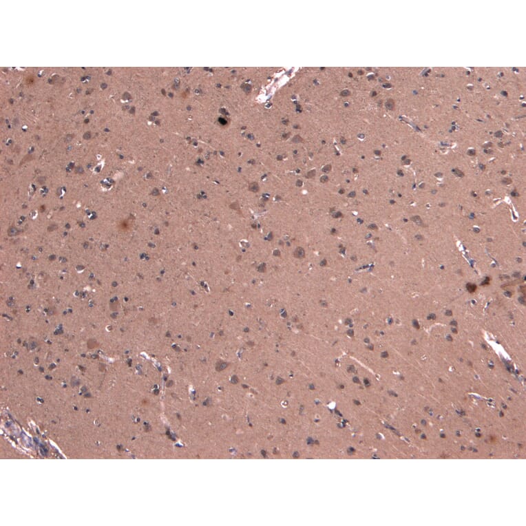 Immunohistochemistry - Anti-DCTN1/p150-glued Antibody (A83458) - Antibodies.com