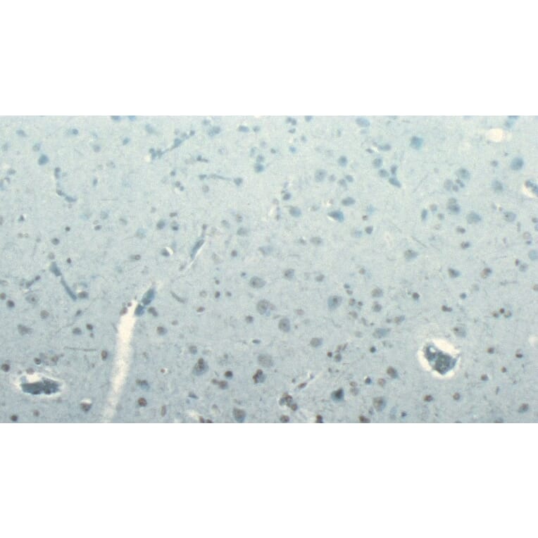 Immunohistochemistry - Anti-DCTN1/p150-glued Antibody (A83458) - Antibodies.com