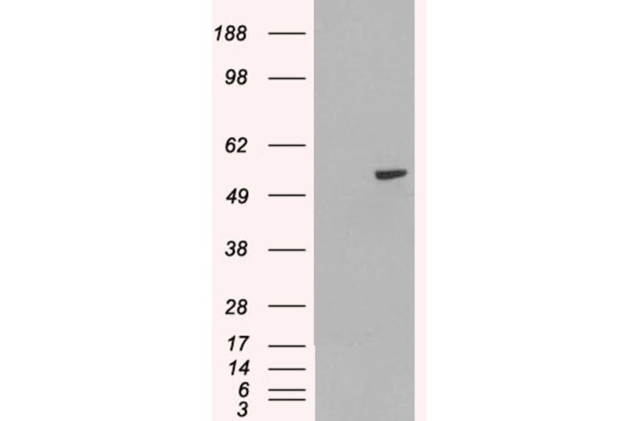 Western Blot - Anti-PAX8 Antibody (A83459) - Antibodies.com