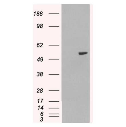 Western Blot - Anti-PAX8 Antibody (A83459) - Antibodies.com