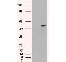 Western Blot - Anti-PAX8 Antibody (A83459) - Antibodies.com