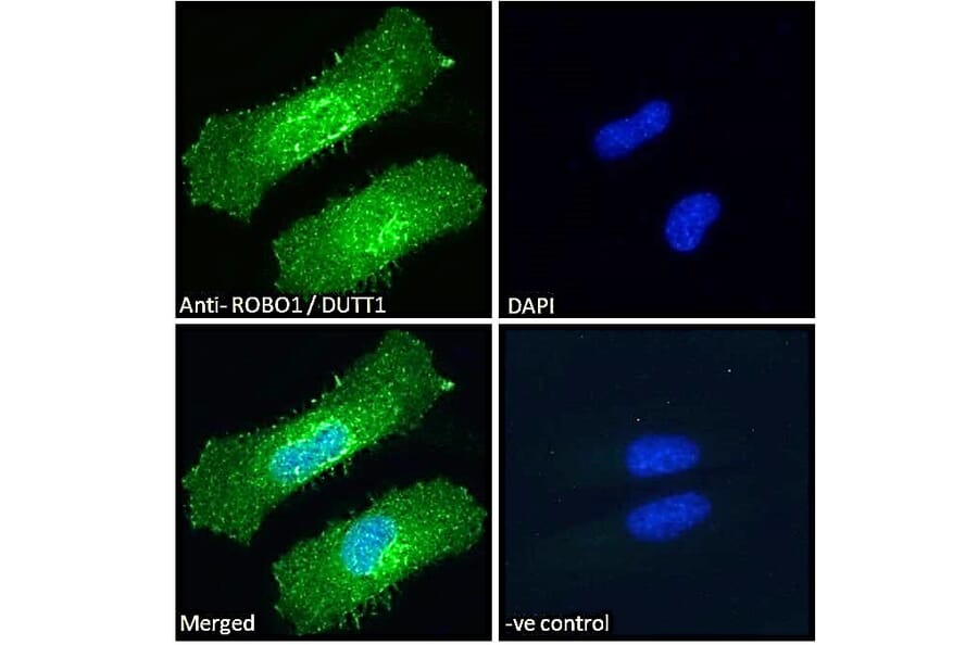 Immunofluorescence - Anti-Robo1 Antibody (A83460) - Antibodies.com