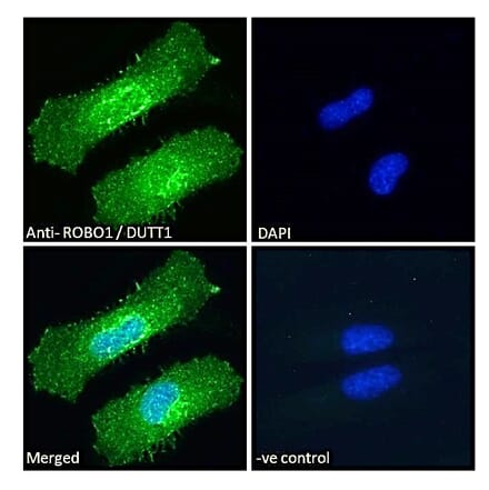 Immunofluorescence - Anti-Robo1 Antibody (A83460) - Antibodies.com