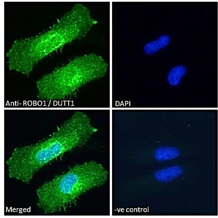 Immunofluorescence - Anti-Robo1 Antibody (A83460) - Antibodies.com