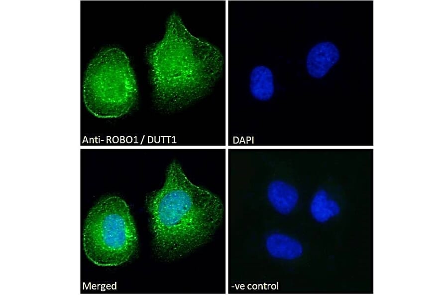 Immunofluorescence - Anti-Robo1 Antibody (A83460) - Antibodies.com