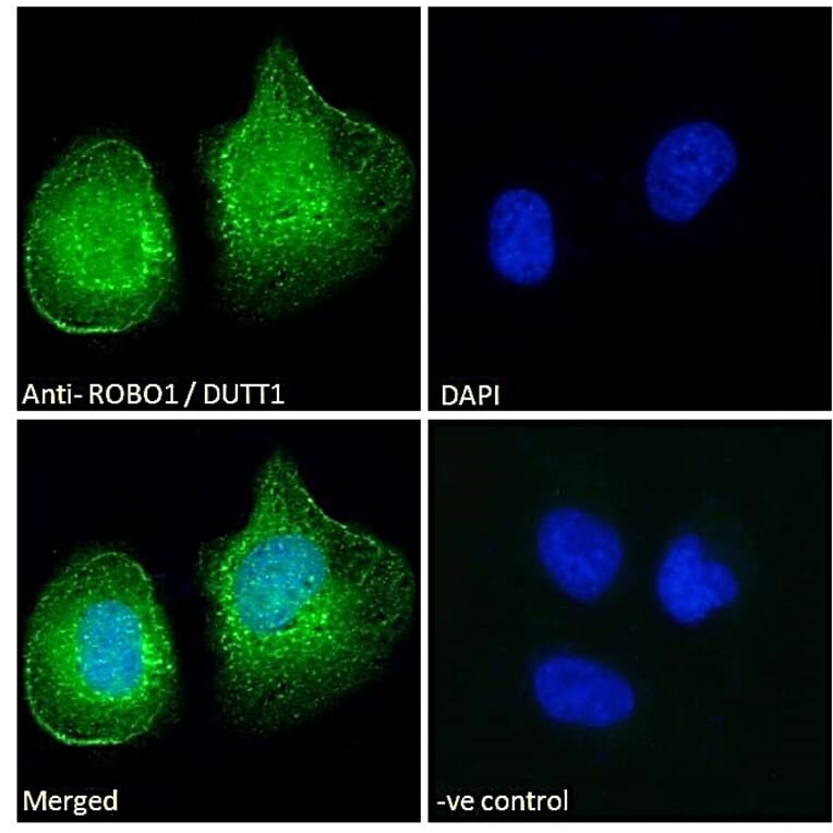Immunofluorescence - Anti-Robo1 Antibody (A83460) - Antibodies.com
