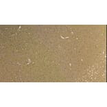 Immunohistochemistry - Anti-Robo1 Antibody (A83460) - Antibodies.com