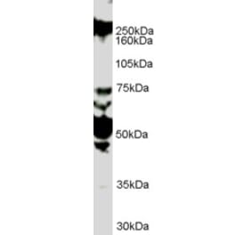 Western Blot - Anti-ROBO1 Antibody (A83460)