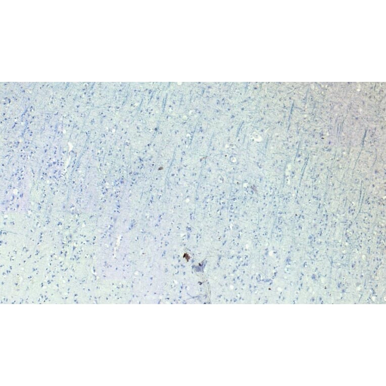 Immunohistochemistry - Anti-Robo1 Antibody (A83460) - Antibodies.com