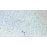 Immunohistochemistry - Anti-Robo1 Antibody (A83460) - Antibodies.com