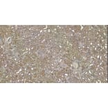 Immunohistochemistry - Anti-Robo1 Antibody (A83460) - Antibodies.com