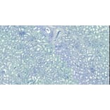 Immunohistochemistry - Anti-Robo1 Antibody (A83460) - Antibodies.com