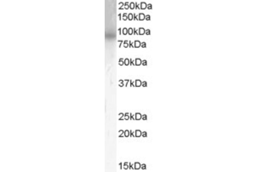 Western Blot - Anti-PDE4B Antibody (A83461) - Antibodies.com