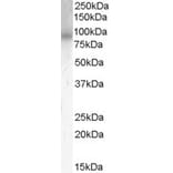Western Blot - Anti-PDE4B Antibody (A83461) - Antibodies.com
