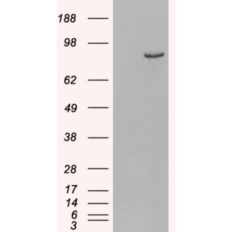 Western Blot - Anti-PDE4B Antibody (A83461) - Antibodies.com