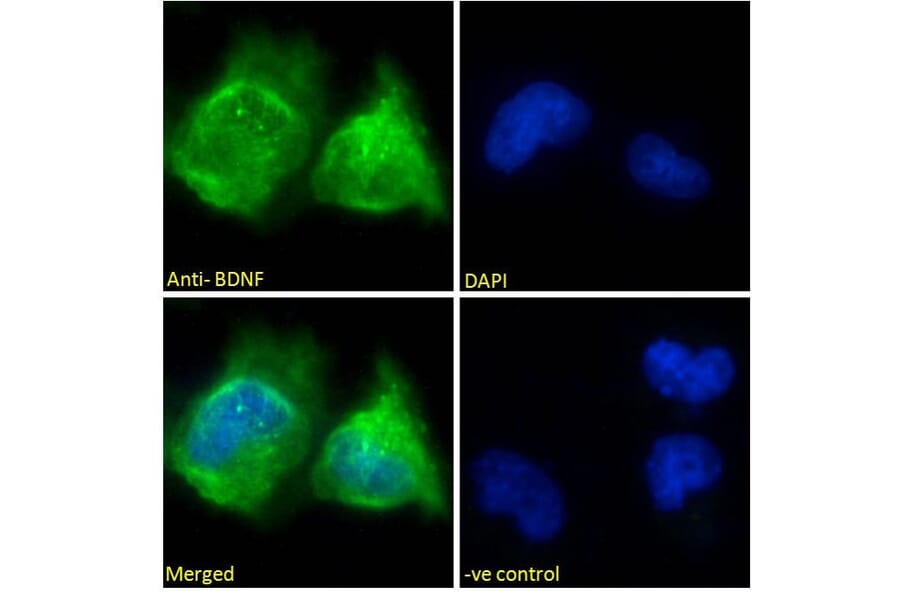 Immunofluorescence - Anti-BDNF Antibody (A83462) - Antibodies.com