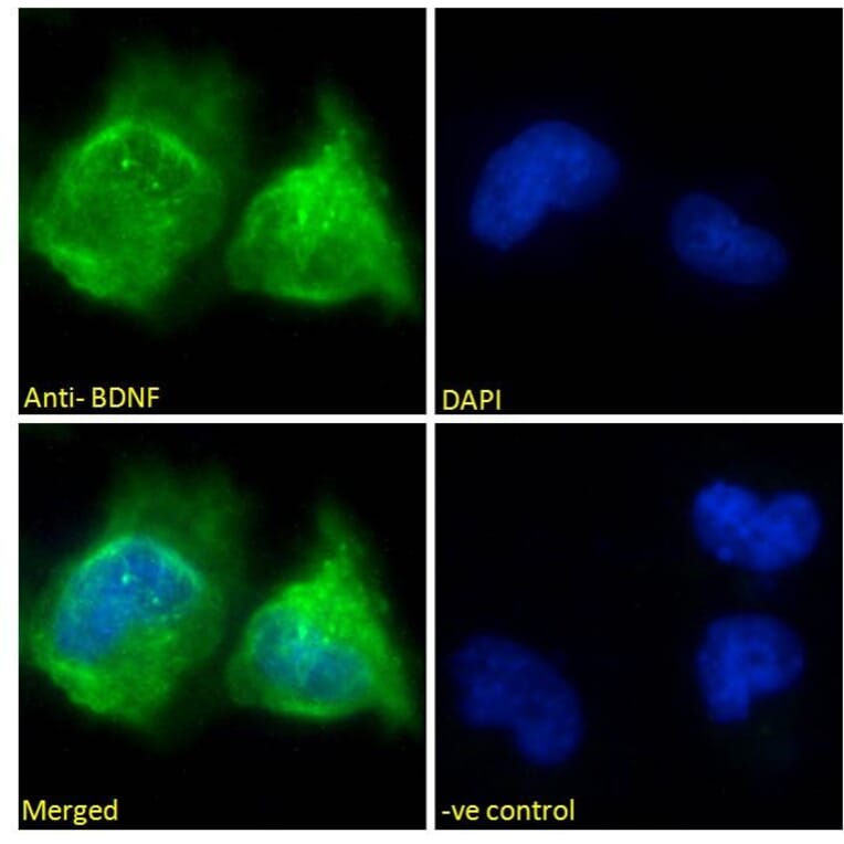 Immunofluorescence - Anti-BDNF Antibody (A83462) - Antibodies.com