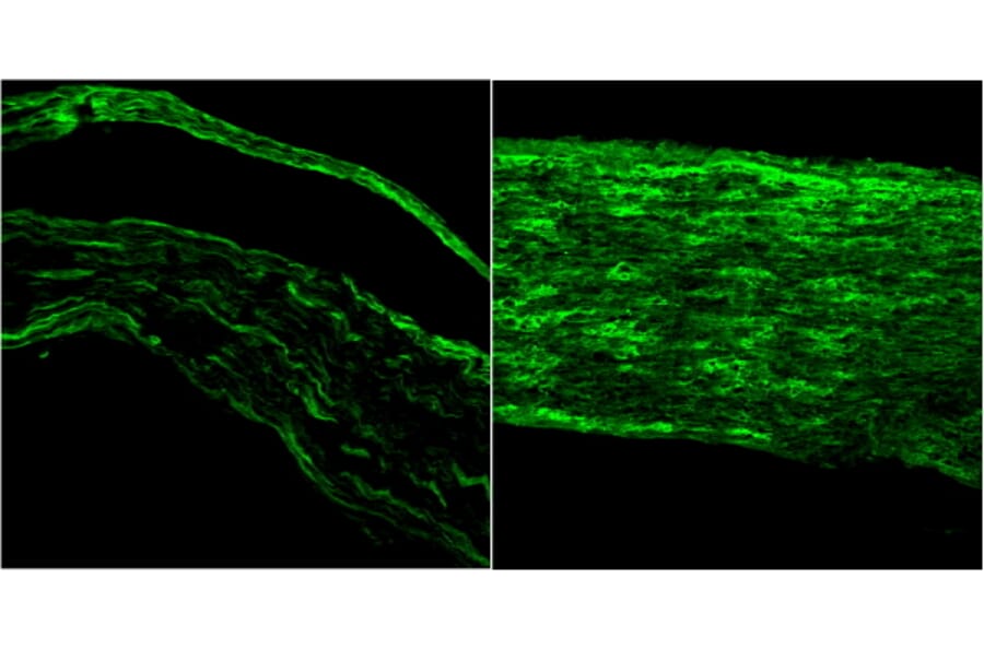 Immunofluorescence - Anti-BDNF Antibody (A83462) - Antibodies.com