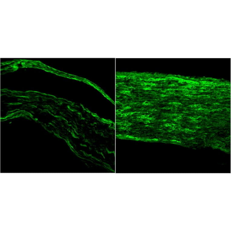 Immunofluorescence - Anti-BDNF Antibody (A83462) - Antibodies.com