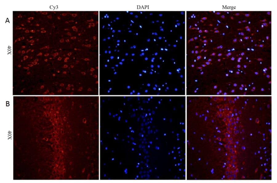 Immunohistochemistry - Anti-BDNF Antibody (A83462) - Antibodies.com