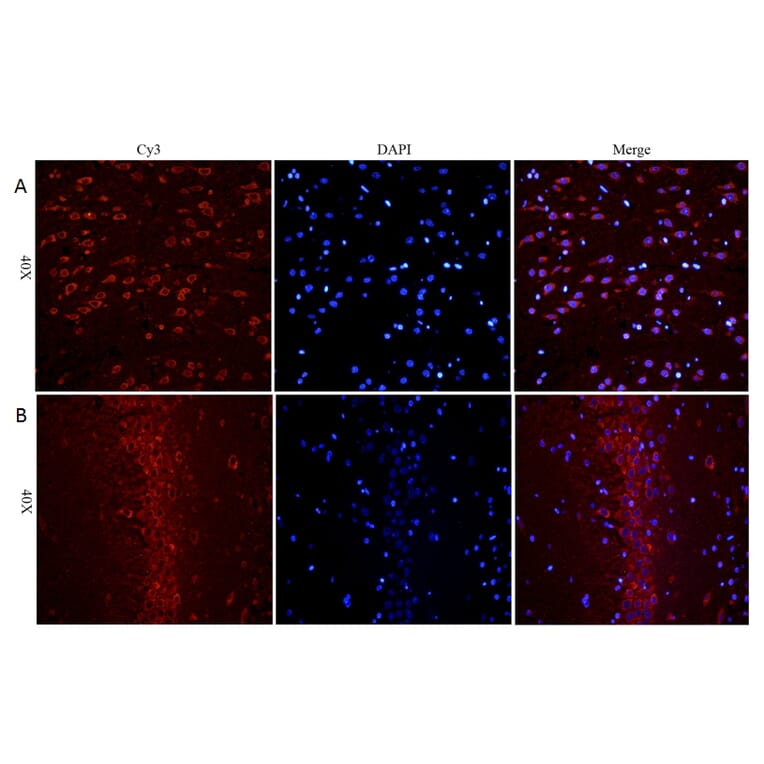 Immunohistochemistry - Anti-BDNF Antibody (A83462) - Antibodies.com