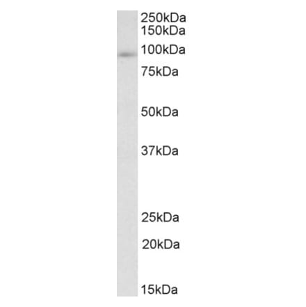 Western Blot - Anti-FYB Antibody (A83463) - Antibodies.com