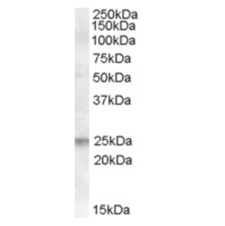 Western Blot - Anti-FAIM Antibody (A83464) - Antibodies.com