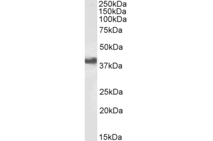 Western Blot - Anti-CD32 Antibody (A83465) - Antibodies.com