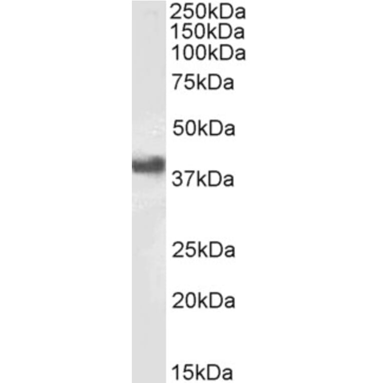Western Blot - Anti-CD32 Antibody (A83465) - Antibodies.com