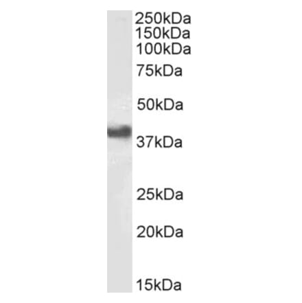 Western Blot - Anti-FCGR2B Antibody (A83465) - Antibodies.com