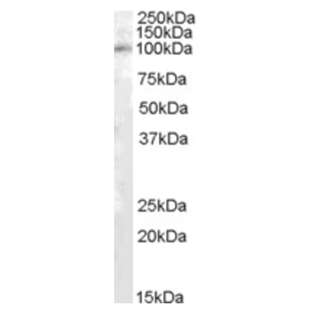 Western Blot - Anti-PAM Antibody (A83466) - Antibodies.com