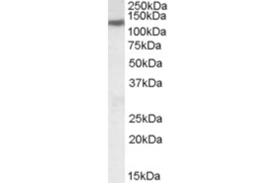 Western Blot - Anti-SLC12A6 Antibody (A83467) - Antibodies.com