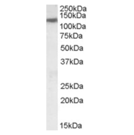 Western Blot - Anti-SLC12A6 Antibody (A83467) - Antibodies.com