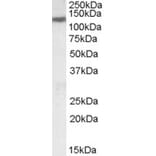 Western Blot - Anti-SLC12A6 Antibody (A83467) - Antibodies.com