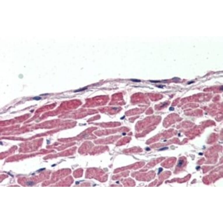 Immunohistochemistry - Anti-SLC12A6 Antibody (A83467) - Antibodies.com