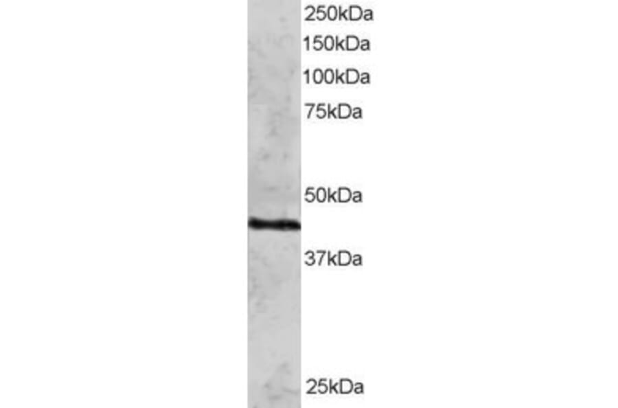 Western Blot - Anti-Rad51C Antibody (A83469) - Antibodies.com