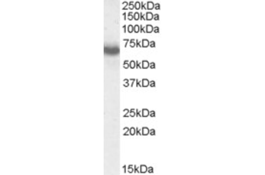 Western Blot - Anti-Ikaros Antibody (A83470) - Antibodies.com